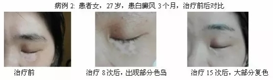 640.webp.jpg
