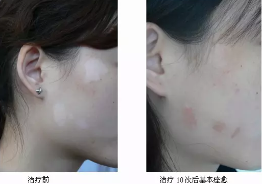 微信截图_20170712175543.png