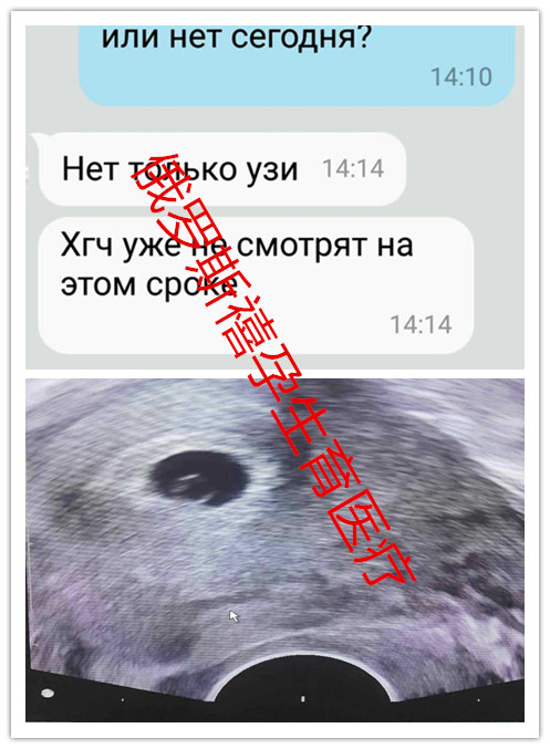 877183154410730223_副本.jpg