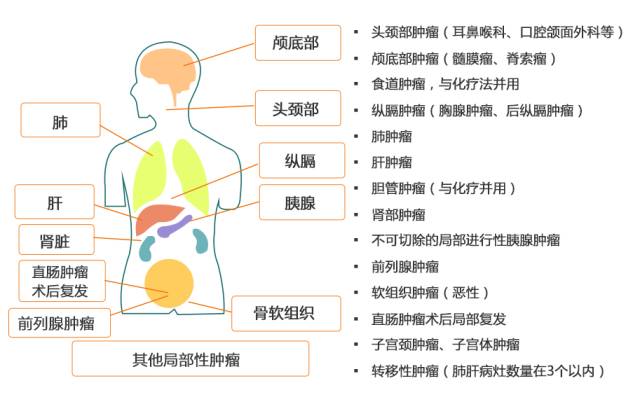 出国看病十一特辑 质子治疗能包治百癌吗？