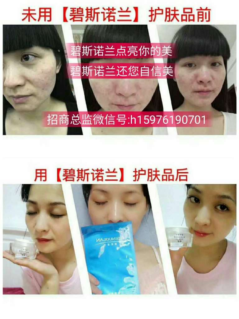 碧斯诺兰怎么代理？需要交多少代理费？碧斯诺兰代理挣钱吗？