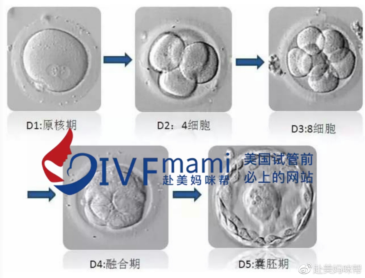 811?美国试管婴儿胚胎等级知多少?