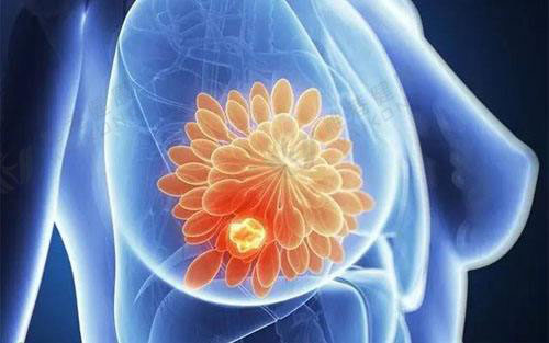 什么是her 2阳性乳腺癌？